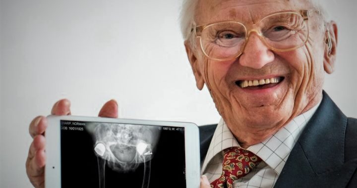 Man with hip xray